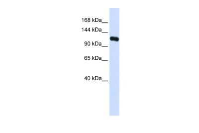 Western Blot: Kinesin 5C Antibody [NBP3-09326]